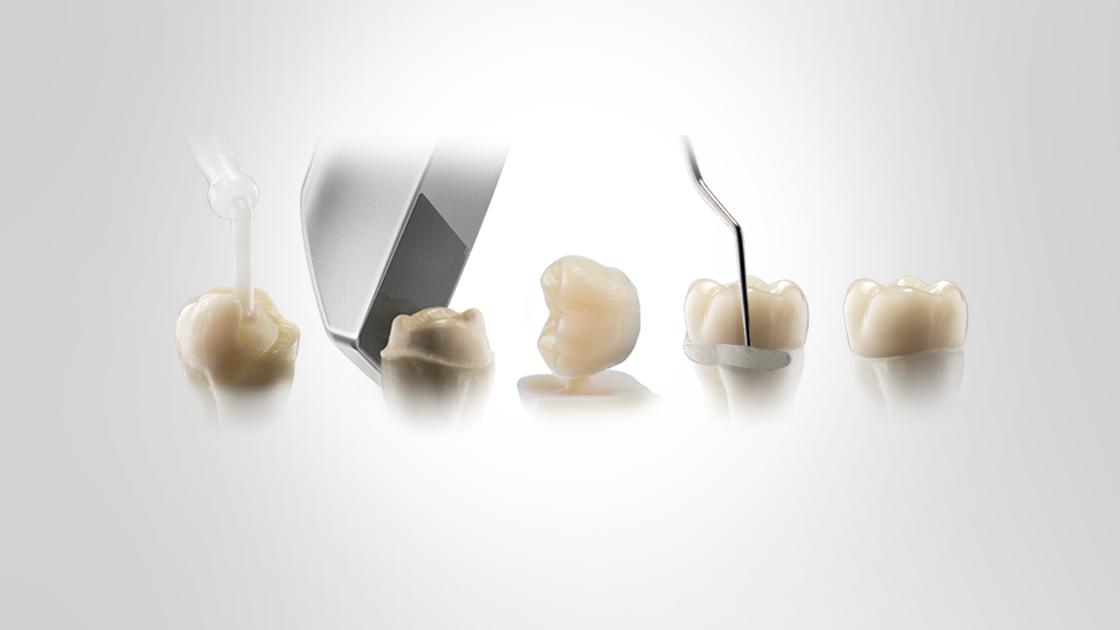 LE NUMERIQUE EN DENTISTERIE RESTAURATRICE