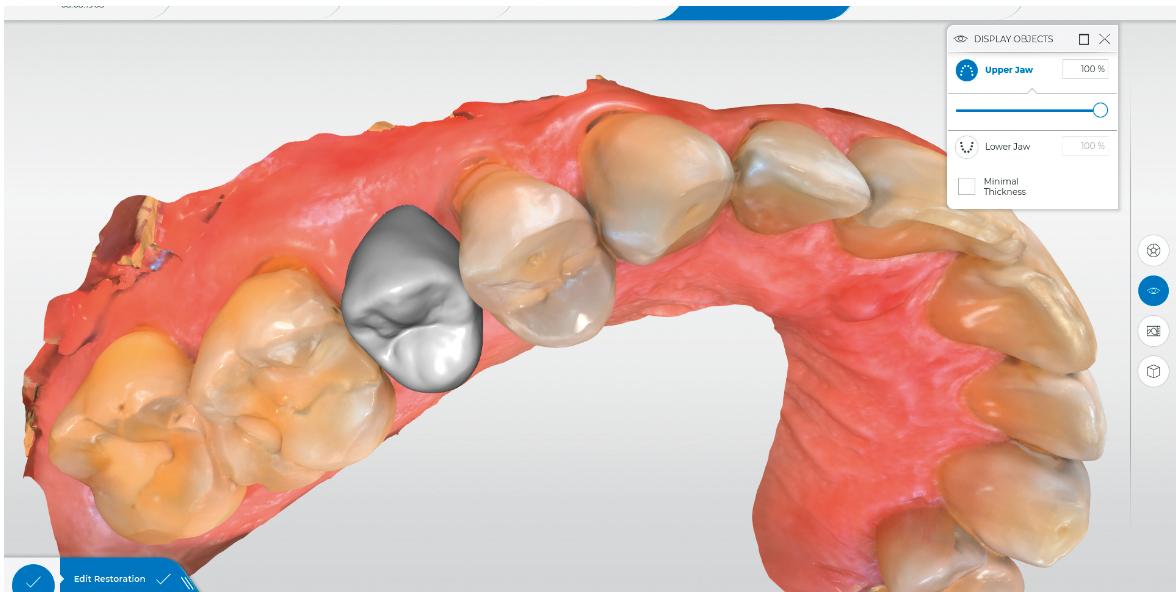 LE NUMERIQUE EN DENTISTERIE RESTAURATRICE