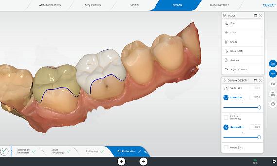 LE NUMERIQUE EN DENTISTERIE RESTAURATRICE