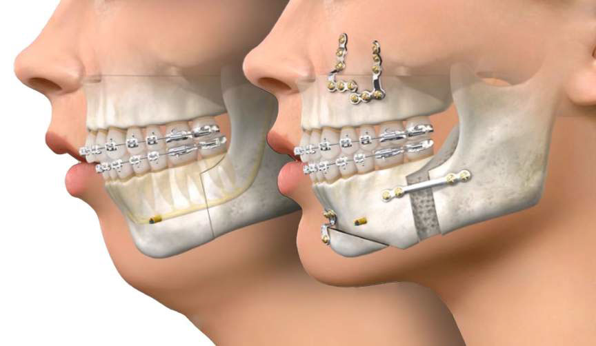 L'orthodontie basique & avancée