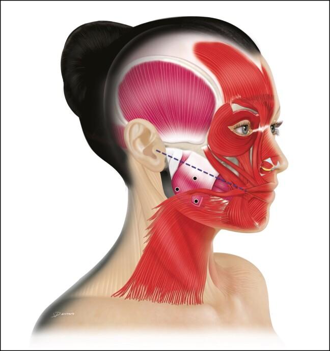 D.U ESTHETIQUE FACIALE (Session 03)
