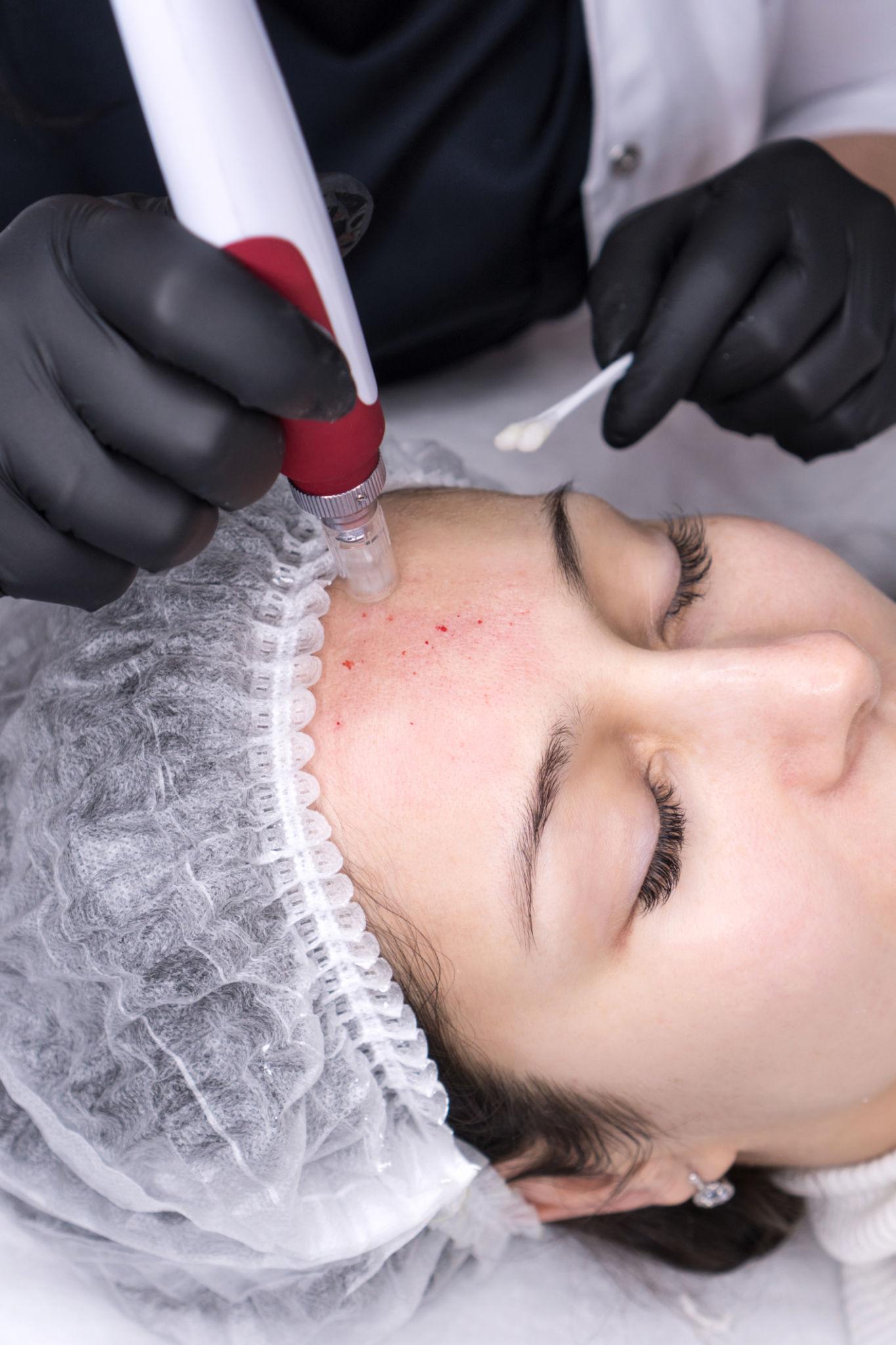 Skin Excellence : maîtrisez l’esthétique cutanée moderne — photo 3