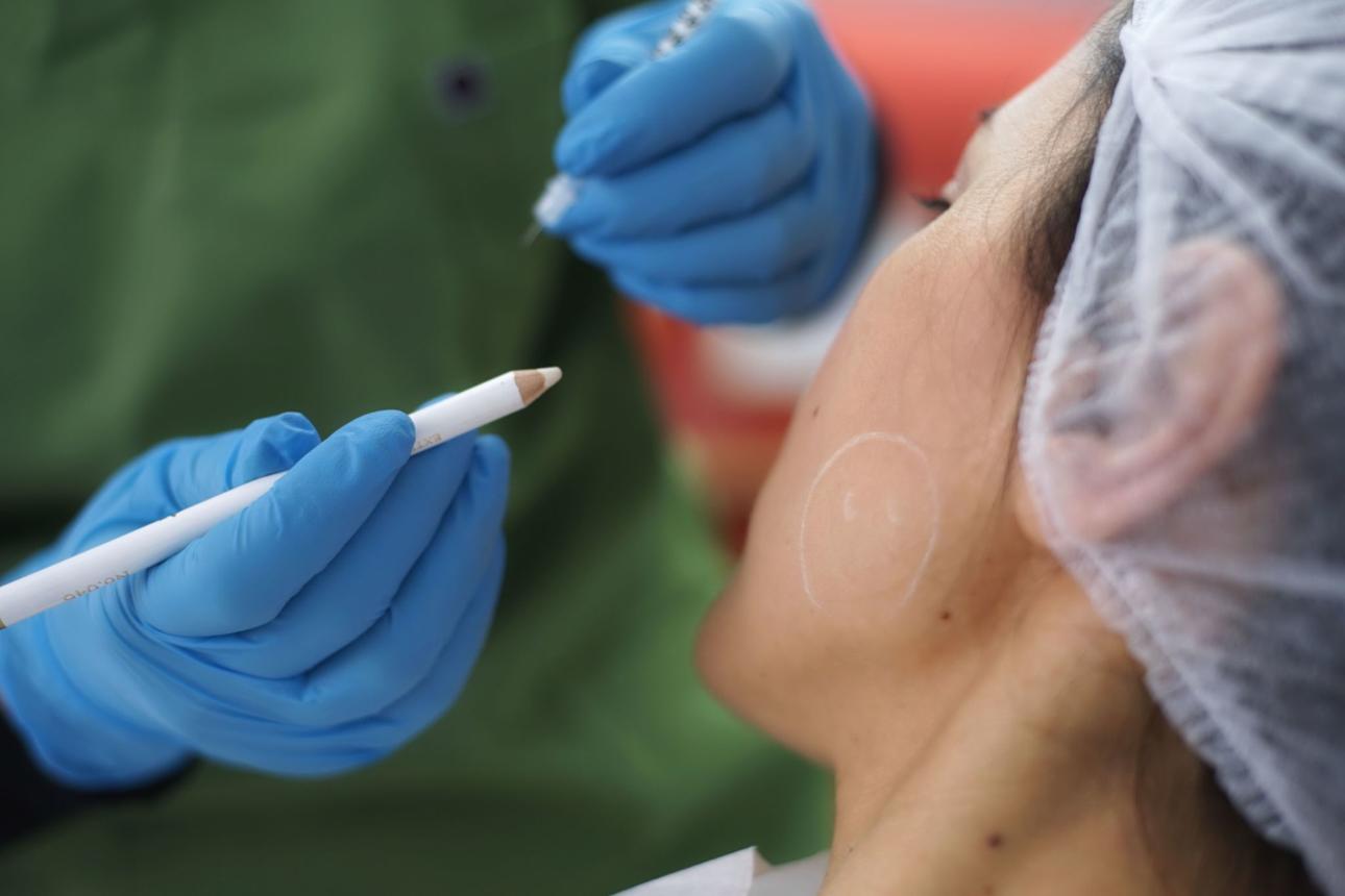Face Sculpting Expert : jawline, menton & Nefertiti Lift