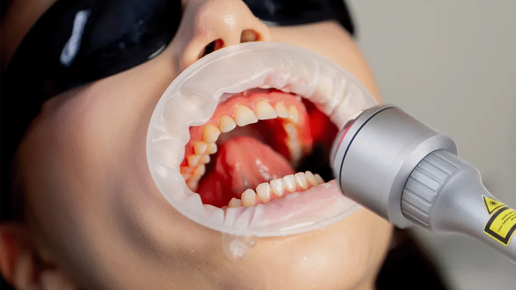 DENTAL LASER