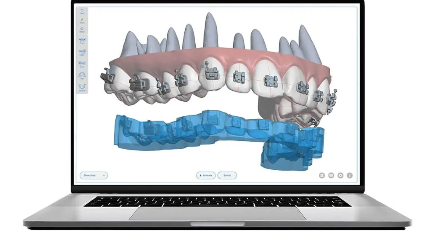 EXTRA :  INITIATION AU DIGITAL ORTHO