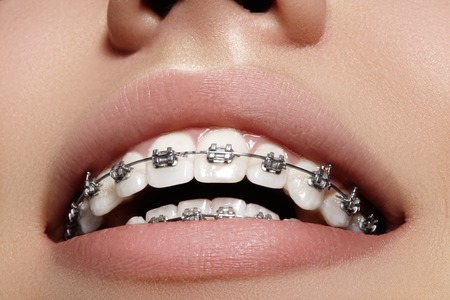 L'orthodontie basique & avancée — photo 1