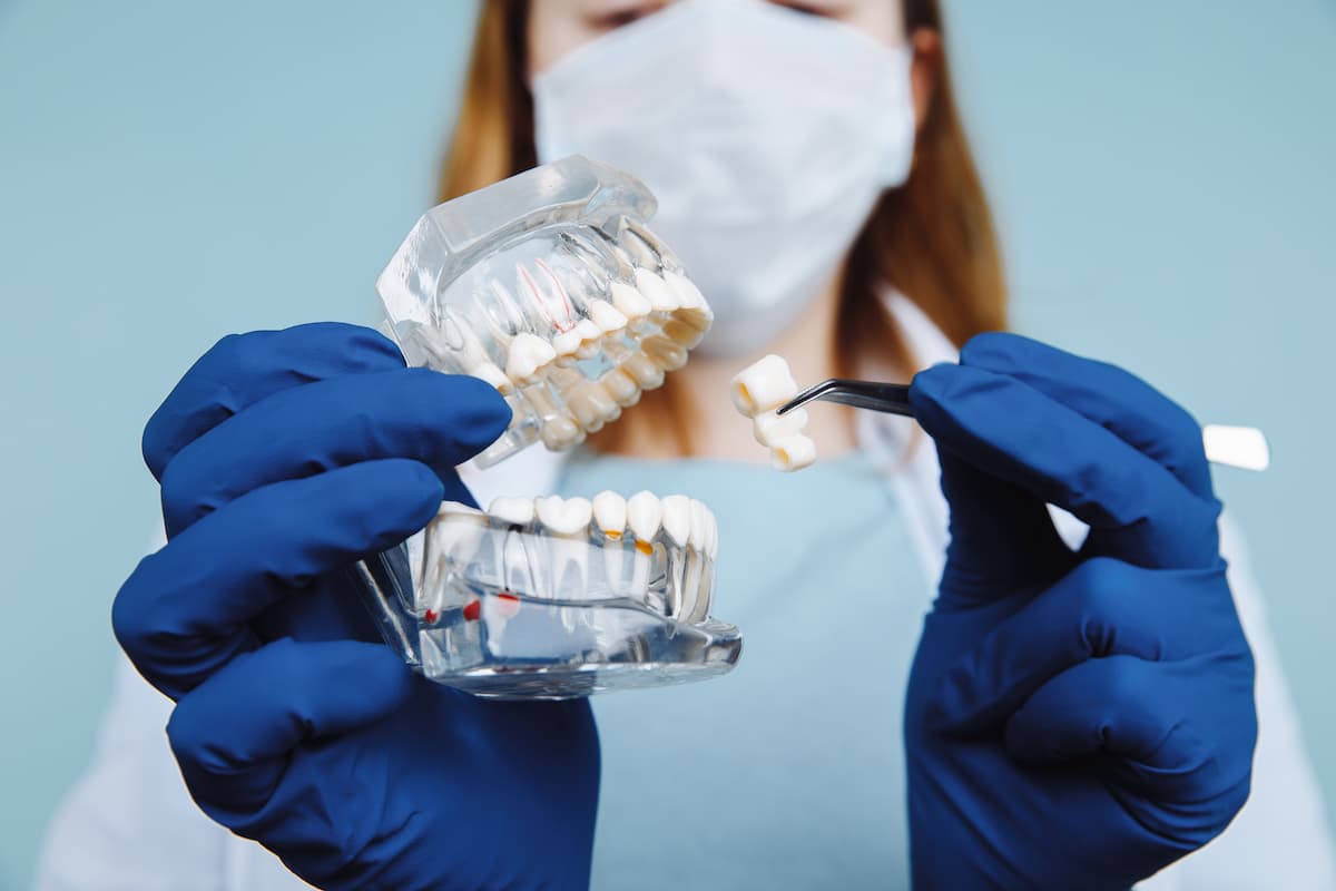 Notions générales sur l'implantologie orale — image 2