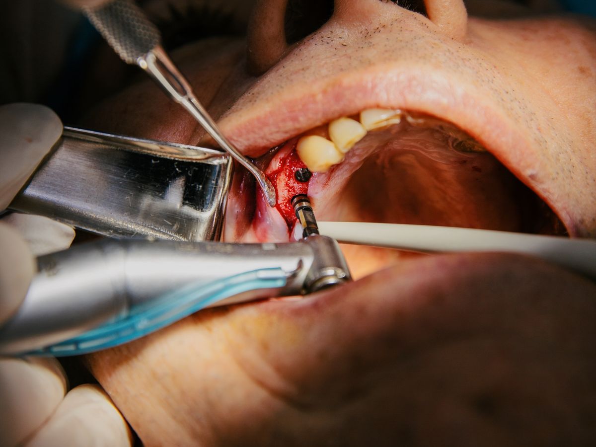 Chirurgie en Implantologie — image 1