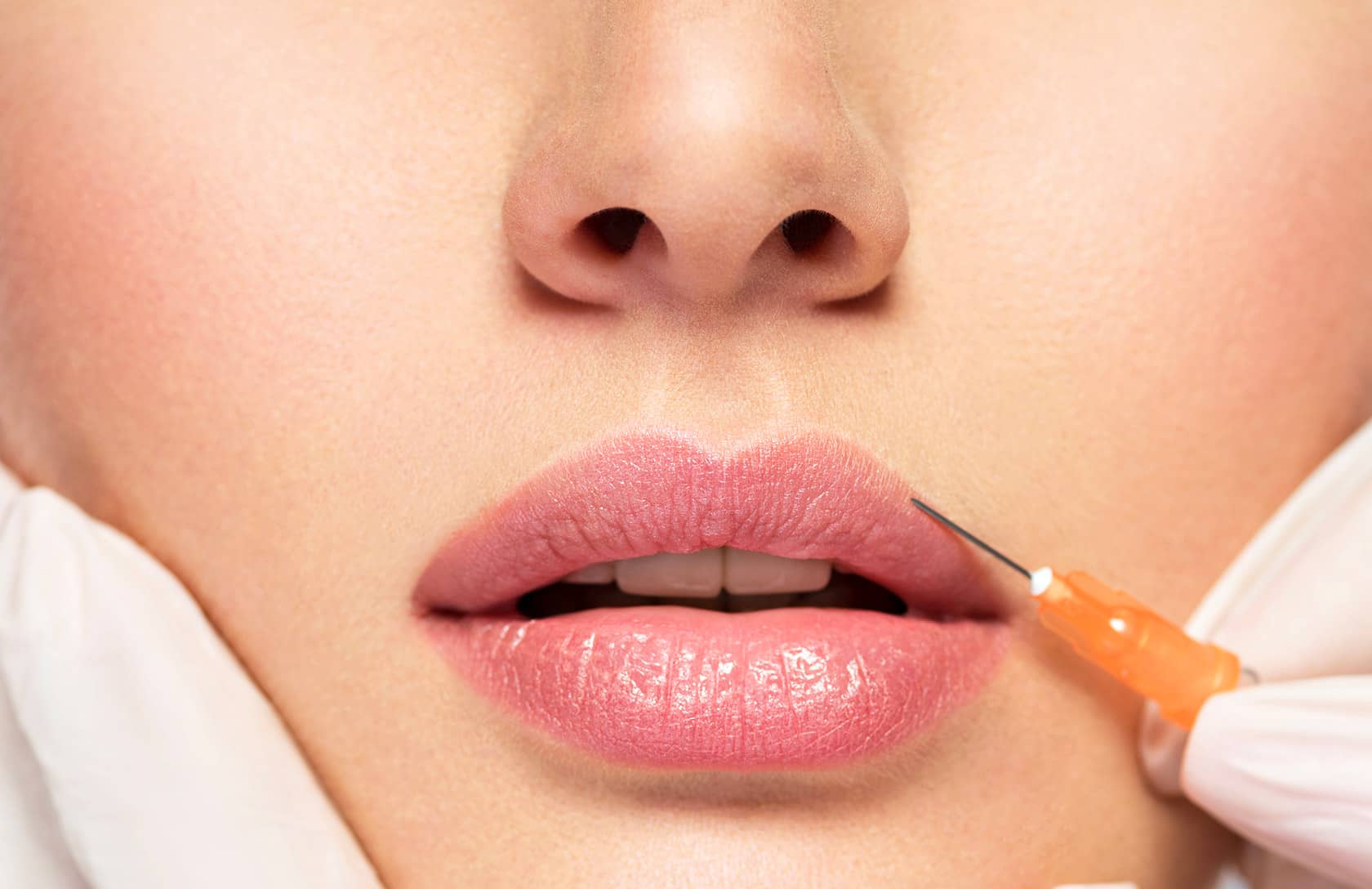 Intégration de la dentisterie esthétique et cosmétique du visage: Botox et produits de comblement dermique (THEORIE + WORKSHOP) + LASER DENTAIRE