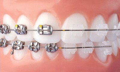 Advanced Dentofacial Orthopedics and case finalization — photo 3
