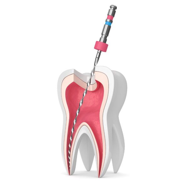 Les Fondamentaux de l’Endodontie Clinique : Accès, Mise en Forme et Obturation  (Théorie et pratique)