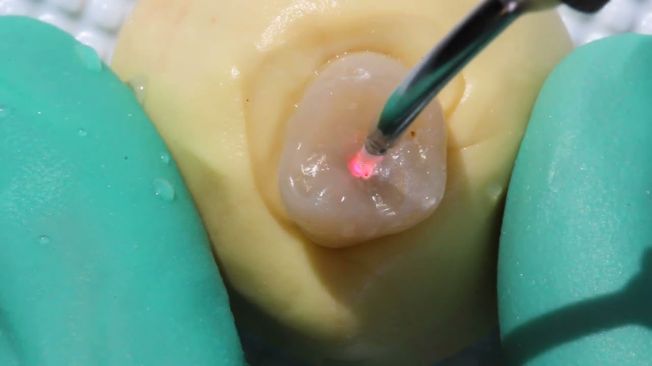 Le laser en Endodontie (MODULE EXTRA) Théorie et pratique