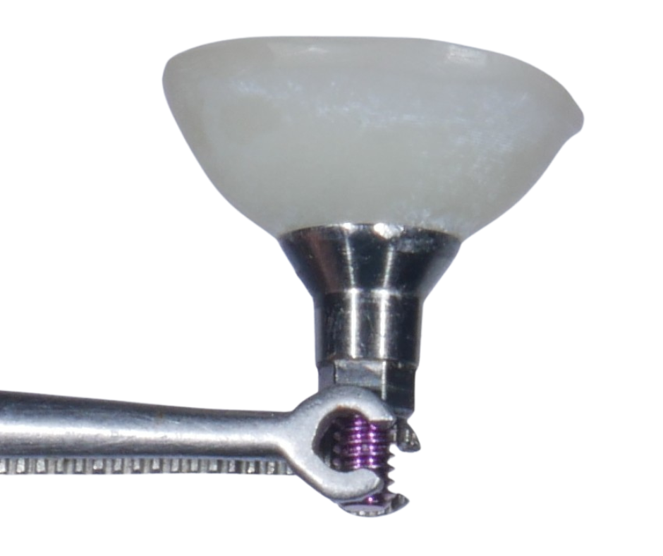 Extraction Implantation Immédiate — photo 1