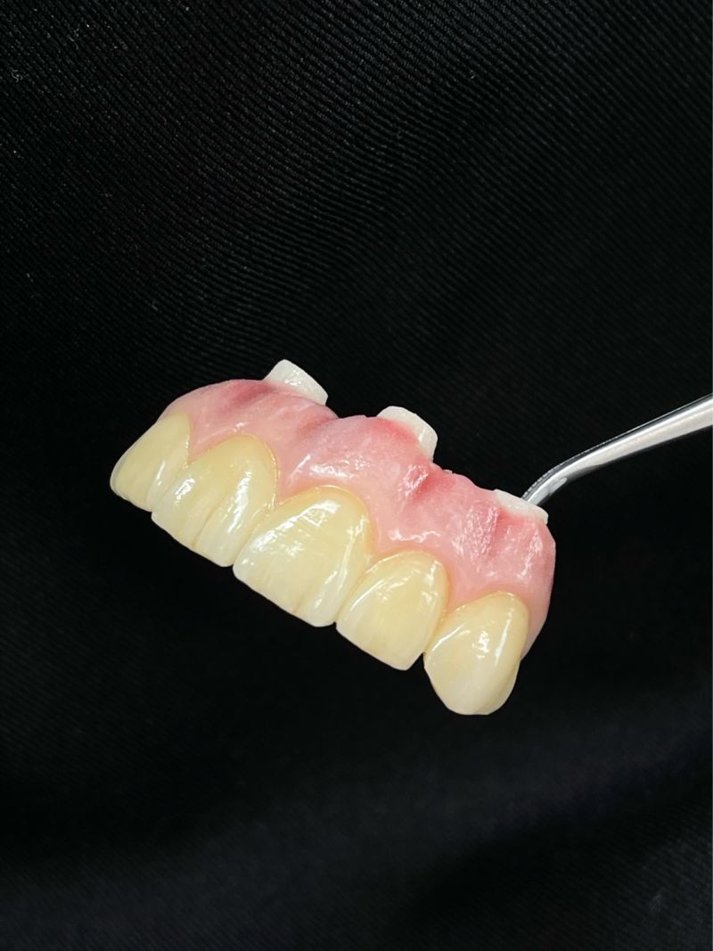 Dentisterie Numérique Avancée : Esthétique Rose & Blanche — image 2