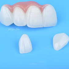 Dentisterie Numérique Avancée : Esthétique Rose & Blanche — image 3